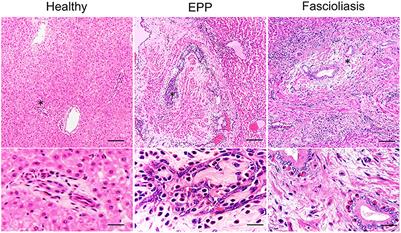 Intrahepatic eosinophilic proliferative phlebitis in Japanese black cattle indicate allergies involving mast cell tryptase-dependent activation